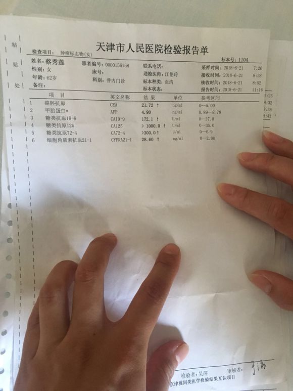 请问大家这能确定是卵巢癌吗？大概到几期了？谢谢