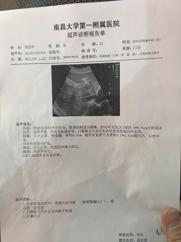 我爸爸检查时肝癌晚期，有没有好一点办法让他老人家延长寿命