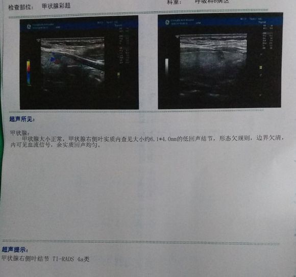 29岁检查出了甲状腺癌，感觉人生灰暗了