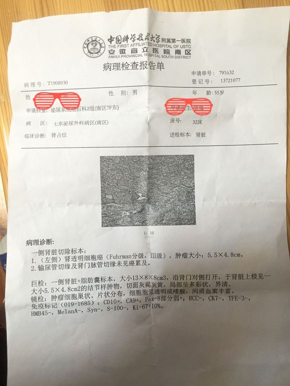 肾癌病友，你们好。