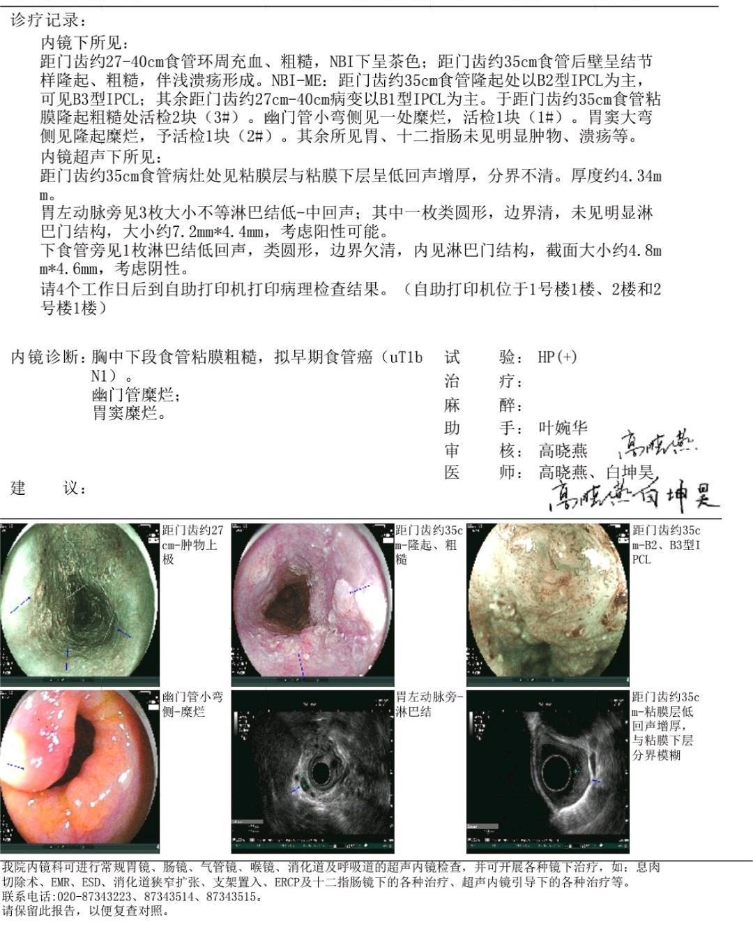 食管癌，现实uT1bN1